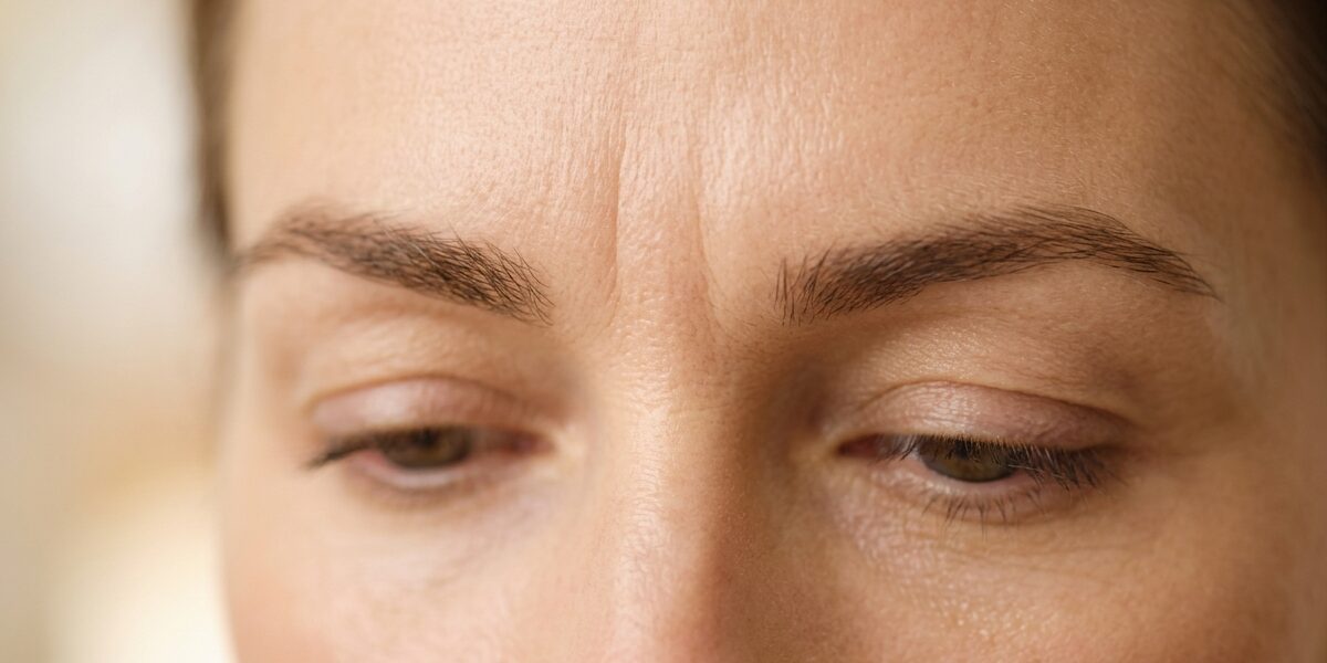 Toxina Botulínica Botox - Entrecejo