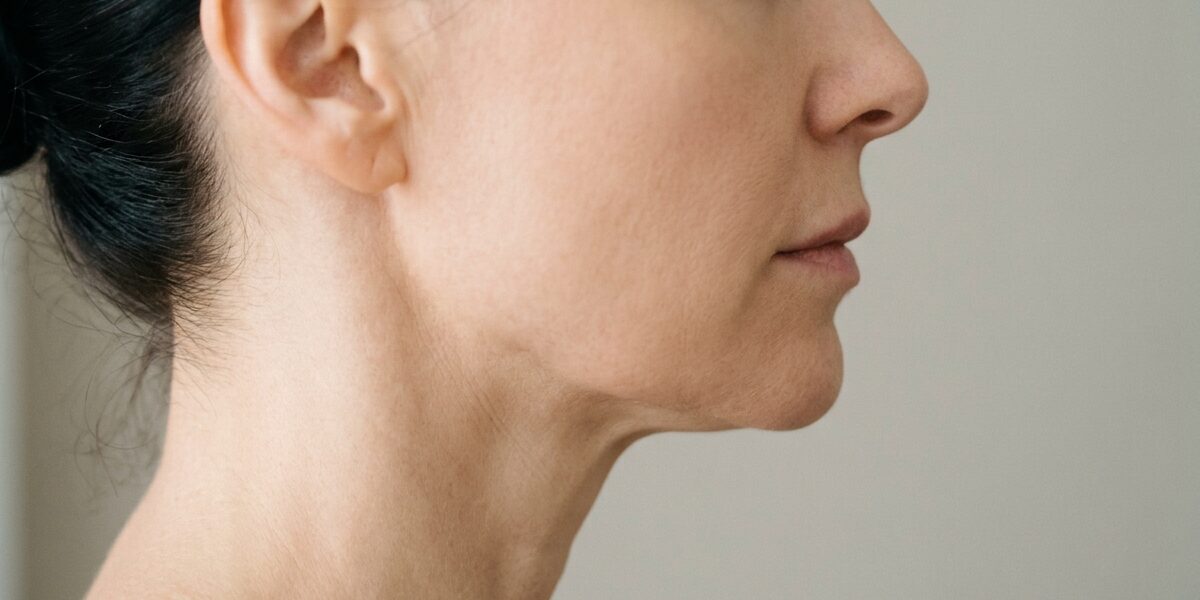 Clínica Sanipiel - Smartlipo Laserlipólisis Madrid - Papada